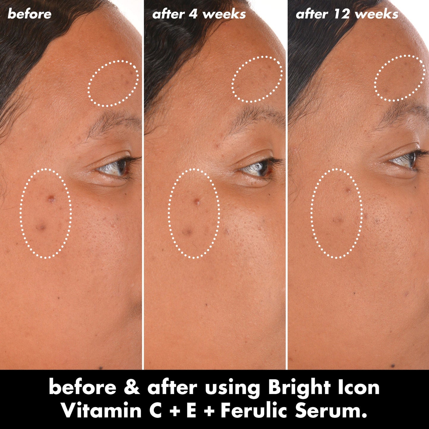 bright-icon-vitamin-c-e-ferulic-serum-p6 0226_EDU_BrightIconVitC_BA_Chanel_TRIPTYCH_c58f2fc8-209d-414f-9ba3-666a07a94887.jpg