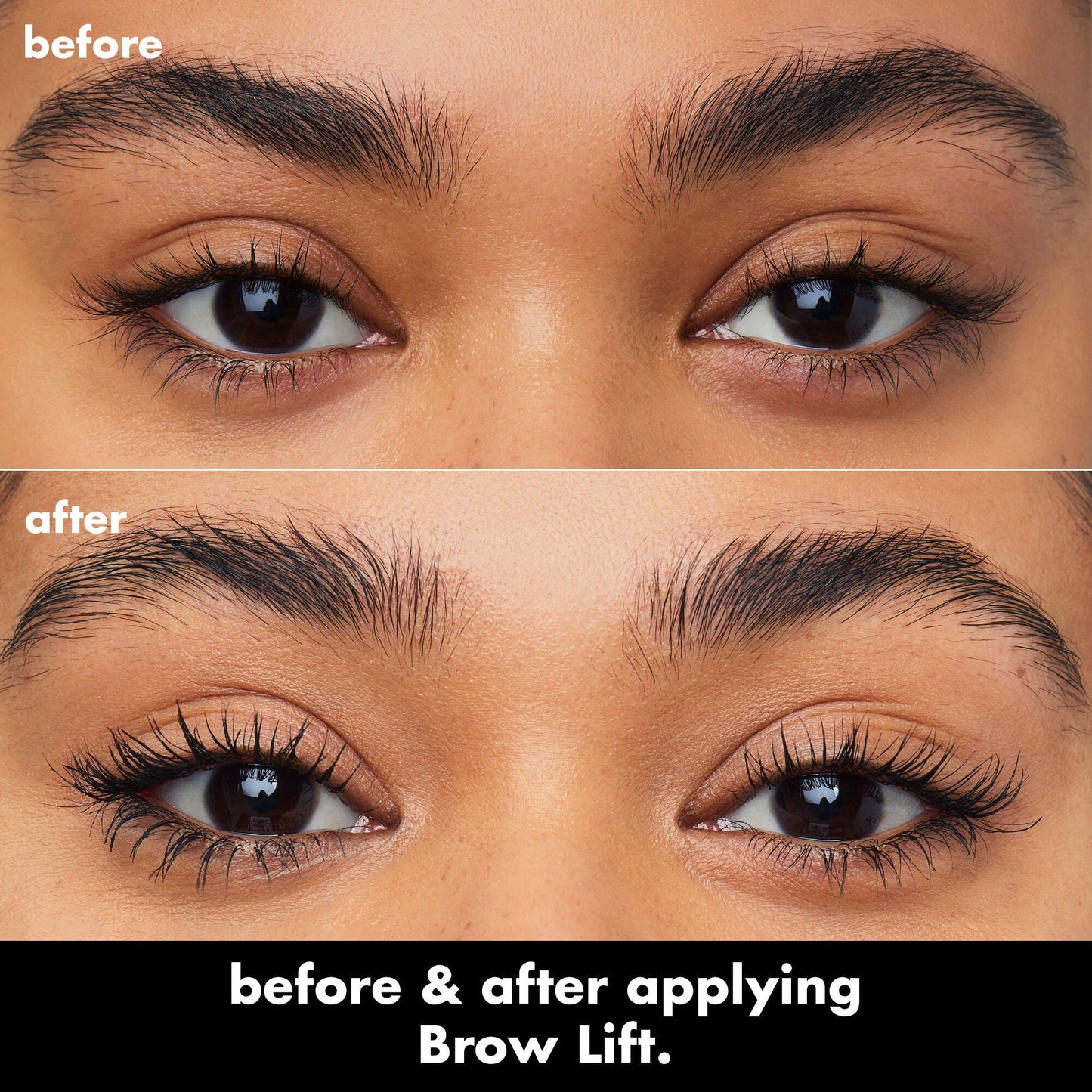 brow-lift-b0 0326_EDU_BrowLift_BA.jpg