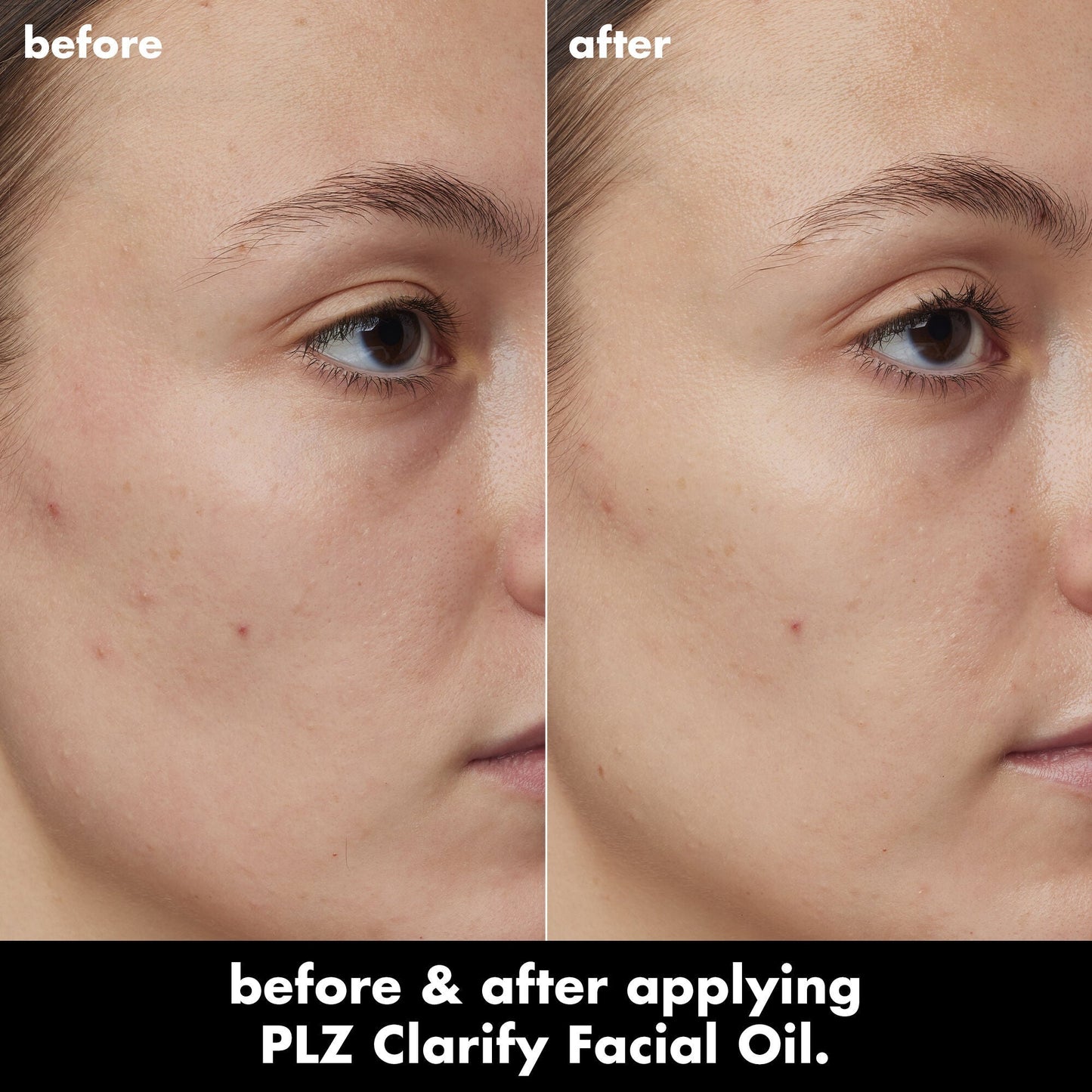 plz-clarify-facial-oil-j0 0326_EDU_PlzClarify_BA_Kelly.jpg