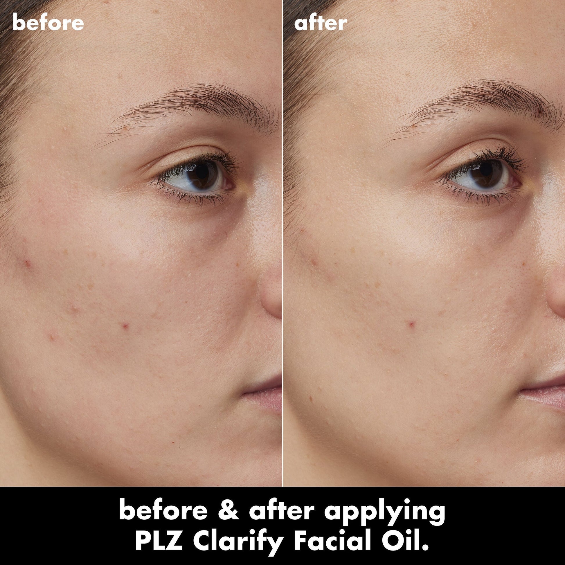 plz-clarify-facial-oil-j0 0326_EDU_PlzClarify_BA_Kelly.jpg
