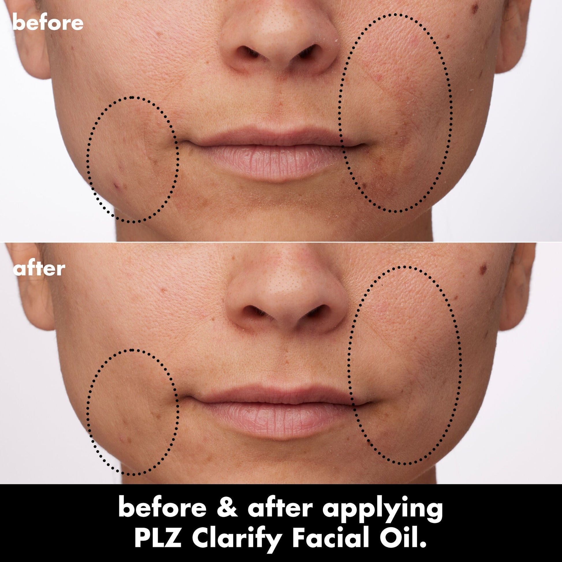 plz-clarify-facial-oil-j0 0326_EDU_PlzClarify_BA_Paula.jpg