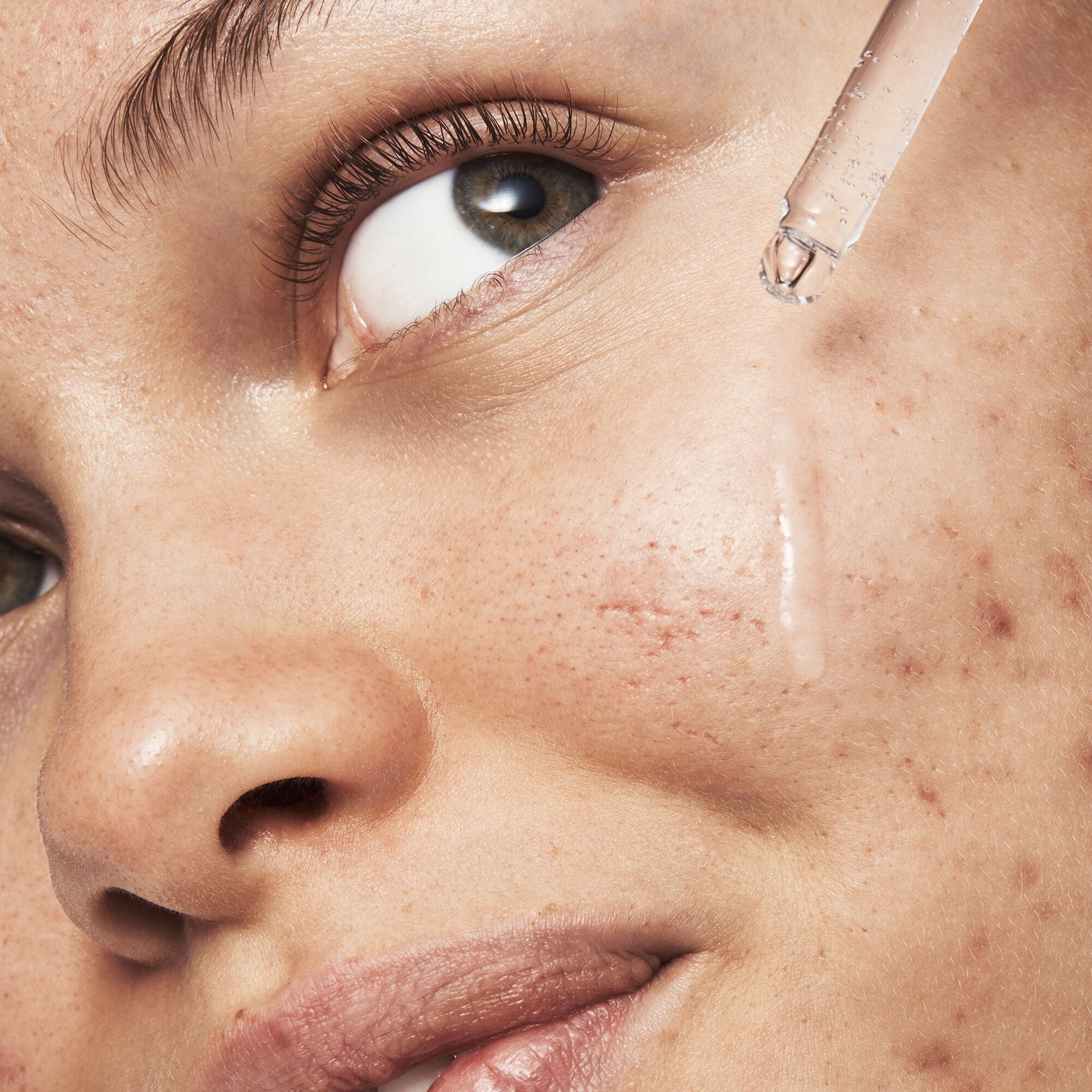 blemish-breakthrough-triple-acid-resurfacing-serum-x5 121321_Marley-Acne-Regimen_0254_FINAL_IGF.jpg