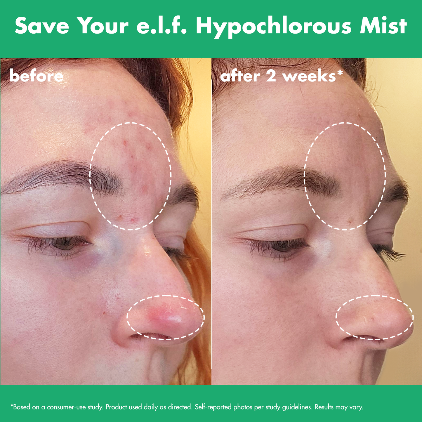 save-your-e-l-f-hypochlorous-mist-a6 FA26_EDUCATION_SAVEYOURELF_USAGE_BA1_WITHOUT_CLAIMS.png
