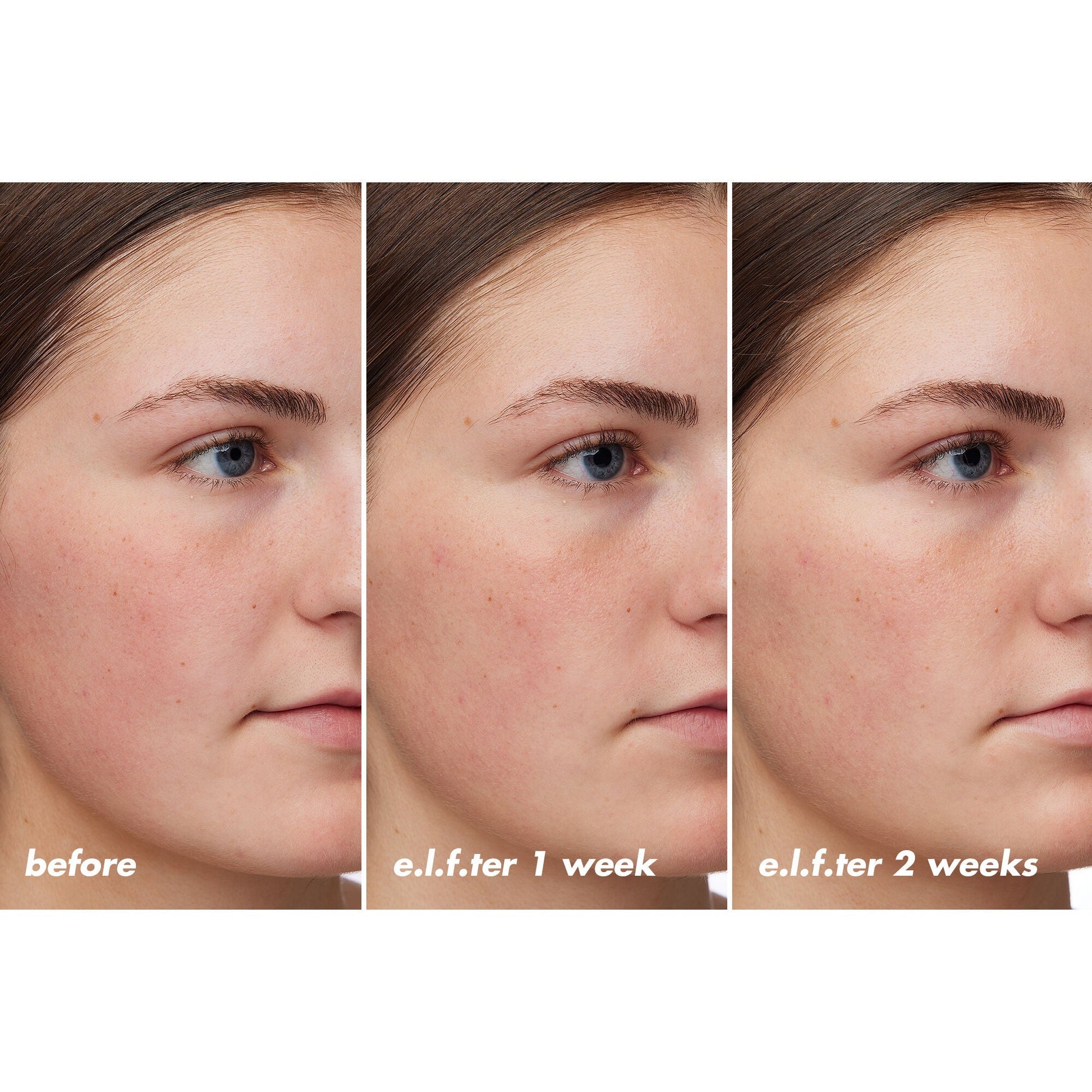 holy-hydration-barrier-goals-cream-regular-a0 XX26_EDUCATION_HH-BarrierGoals_B_A_Zoe_TRYPTICH_74c905bd-67bd-4b91-b633-2b01a8905cb8.jpg